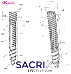 Sacrix 3D Porous Threaded Implant For Minimally Invasive Percutaneous Lateral-Oblique Sacroiliac Joint Fusion Technique