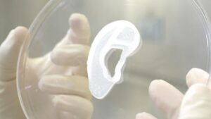سب سے پہلے، ڈاکٹروں نے مریض کے اپنے سیلز پلیٹو بلاکچین ڈیٹا انٹیلی جنس سے بنا ایک 3D پرنٹ شدہ کان ٹرانسپلانٹ کیا۔ عمودی تلاش۔ عی