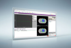 In vivo dosimetria RadCalcin 3D EPID-moduulilla: käyttöönotto ja ensimmäiset kliiniset tulokset PlatoBlockchain Data Intelligence. Pystysuuntainen haku. Ai.