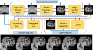 Incorporating deep learning into X-ray CT imaging PlatoAiStream Data Intelligence. Vertical Search. Ai.