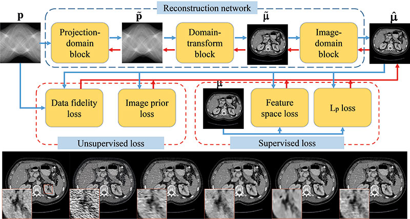 گنجاندن یادگیری عمیق در تصویربرداری CT اشعه ایکس، هوش داده پلاتوبلاک چین. جستجوی عمودی Ai.