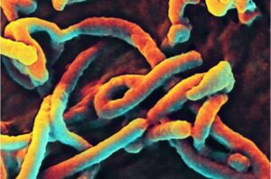 Enhed med hviskende galleritilstand tilbyder hurtig Ebola-diagnose PlatoBlockchain Data Intelligence. Lodret søgning. Ai.