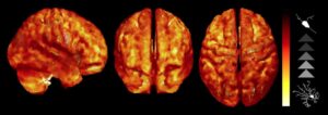 Researchers produce first in vivo images of brain inflammation using MRI PlatoAiStream Data Intelligence. Vertical Search. Ai.
