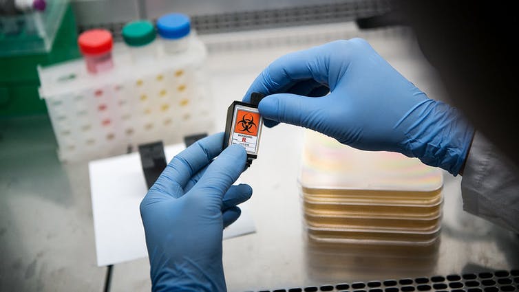 Ręce w rękawiczkach trzymające próbkę zagrożenia biologicznego w laboratorium