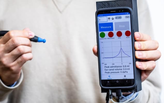 Il test su smartphone fornisce uno screening conveniente della funzione dell'orecchio medio PlatoBlockchain Data Intelligence. Ricerca verticale. Ai.