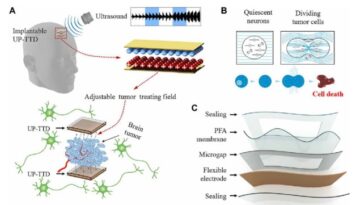 Ultrasound-powered implant treats brain cancer using electromagnetic fields PlatoBlockchain Data Intelligence. Vertical Search. Ai.