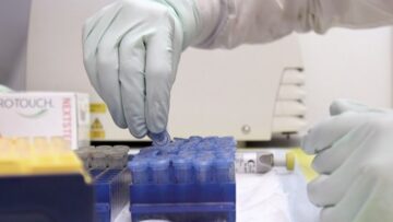اكتشف علماء جامعة ديوك مكونًا فعالًا محتملًا ضروريًا للقاح فيروس نقص المناعة البشرية PlatoBlockchain Data Intelligence. البحث العمودي. منظمة العفو الدولية.