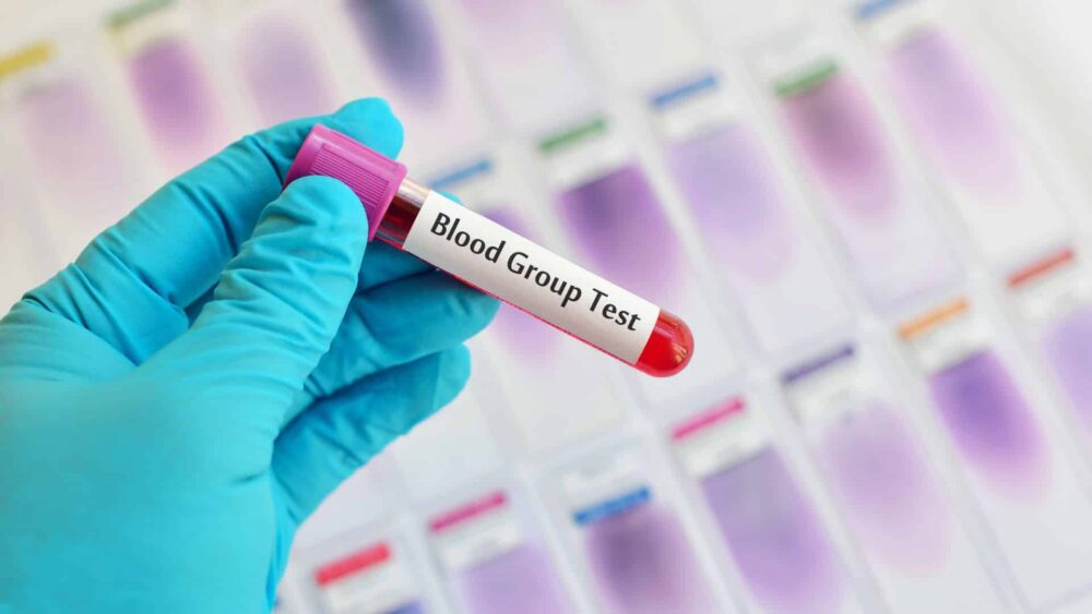 Gli scienziati hanno scoperto un nuovo raro sistema di gruppi sanguigni PlatoBlockchain Data Intelligence. Ricerca verticale. Ai.