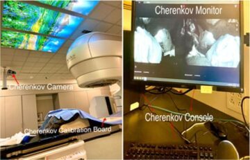 Imagem de Cherenkov para visualização de radioterapia: um ano de uso clínico PlatoBlockchain Data Intelligence. Pesquisa vertical. Ai.