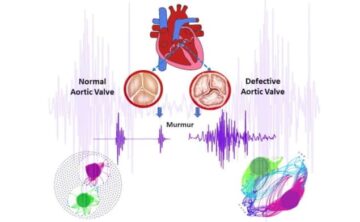 Listening for disease: heart sound maps provide low-cost diagnosis PlatoBlockchain Data Intelligence. Vertical Search. Ai.