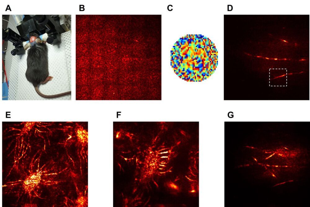 Novi mikroskop omogoča znanstvenikom, da vidijo skozi lobanjo in slikajo možgane PlatoBlockchain Data Intelligence. Navpično iskanje. Ai.