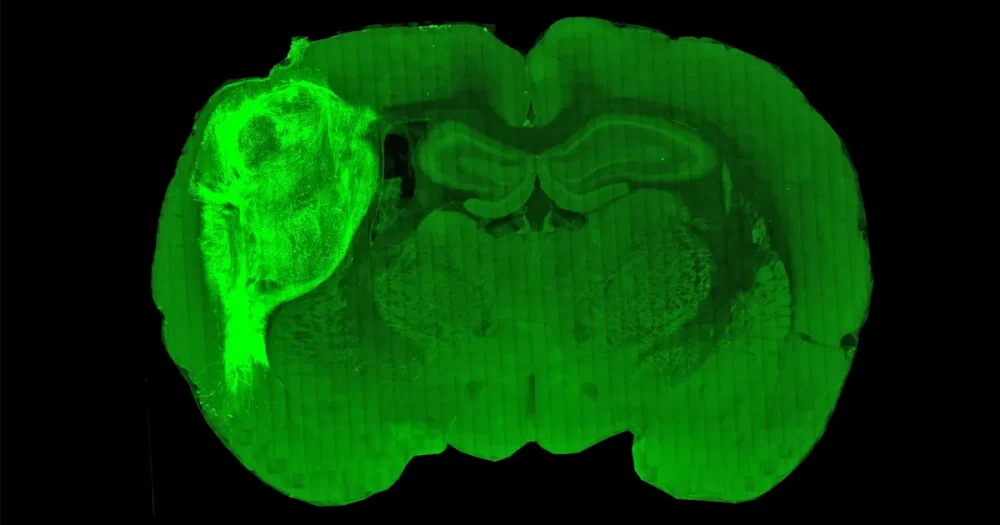 سلول های انسانی رشد یافته در آزمایشگاه مدارهای کاری را در هوش داده پلاتو بلاک چین مغز موش تشکیل می دهند. جستجوی عمودی Ai.