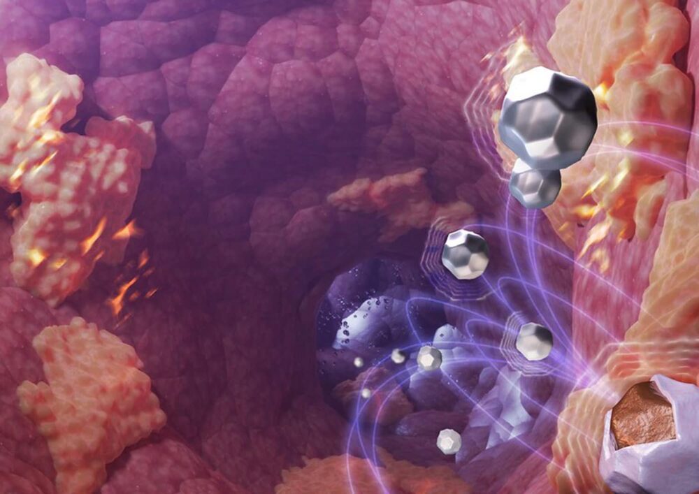 Nya, värmeeffektiva nanopartiklar för behandling av cancer PlatoBlockchain Data Intelligence. Vertikal sökning. Ai.