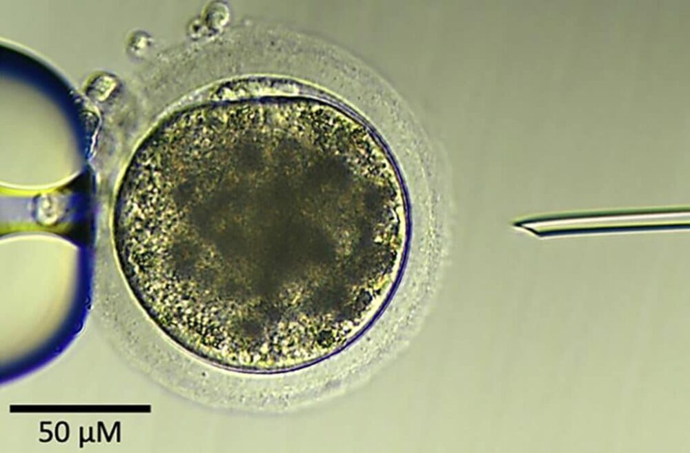 een intracytoplasmatische sperma-injectie