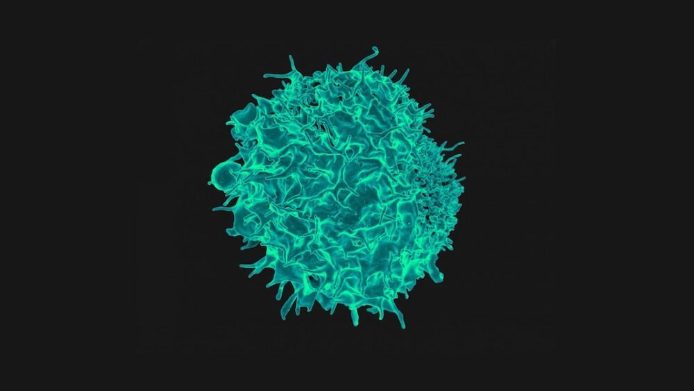 Sel-sel yang Direkayasa Ini Adalah Tentara Super Yang Memburu Kecerdasan Data PlatoBlockchain Cancer. Pencarian Vertikal. Ai.