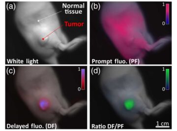 Vertraagde fluorescentiebeeldvorming helpt bij het identificeren van kankerweefsel tijdens operaties PlatoBlockchain Data Intelligence. Verticaal zoeken. Ai.