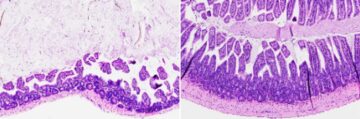 ترکیب جدید التهاب روده را در موش ها با هوش داده PlatoBlockchain معکوس می کند. جستجوی عمودی Ai.