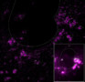 koronavírussal fertőzött sejt szupermikroszkópia