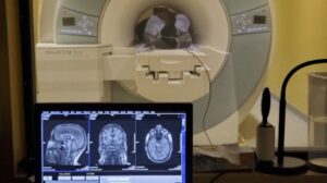 Stimulering af hjernen ved 40 Hz til behandling af Alzheimers sygdom