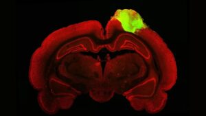 مینی مغزهای انسانی پیوند زده شده به موش های آسیب دیده بینایی خود را بازیابی کرد