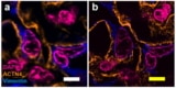 Expansion microscopy of human kidney