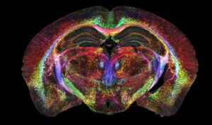 Mouse brain imaging reaches record-breaking resolution