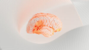 Kirurger simulerar hela hjärnor för att fastställa källan till sina patienters anfall