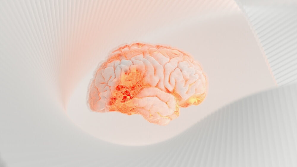 Các bác sĩ phẫu thuật đang mô phỏng toàn bộ não bộ để xác định nguồn cơn động kinh của bệnh nhân