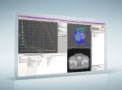 LAP’s RadCalc software ensures independent QA for Gamma Knife Perfexion treatment planning PlatoBlockchain Data Intelligence. Vertical Search. Ai.