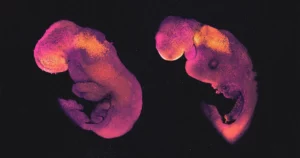 "Embryomodeller" utmanar juridiska, etiska och biologiska koncept | Quanta Magazine