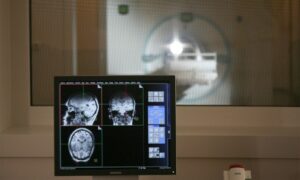 MR 분광법은 방사선 없이도 뇌 포도당 대사를 매핑합니다.