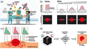 Multispectral infrared imaging improves guidance of cancer surgery – Physics World