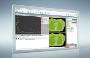 Controle de qualidade automatizado do paciente usando o software RadCalc para tratamentos de tomoterapia helicoidal no University Hospital Cologne – Physics World