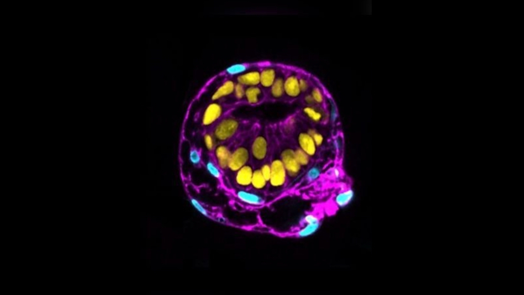 Scientists Race to Engineer Human Embryo Models From Stem Cells developmental PlatoBlockchain Data Intelligence. Vertical Search. Ai.