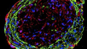Los organoides cardíacos modificados con nanocables restauraron la función cardíaca en ratas