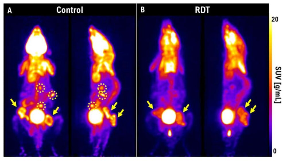 Terapia radiodinámica: aprovechamiento de la luz para mejorar los tratamientos contra el cáncer – Physics World
