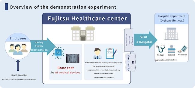 Fujitsu and iSurgery launch bone health promotion project in Japan with Jikei University School of Medicine aiming for early detection of osteoporosis DX PlatoBlockchain Data Intelligence. Vertical Search. Ai.