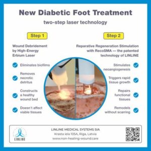 Banebrytende studie avslører effektiviteten av ny RecoSMA laserbehandling for diabetisk fot
