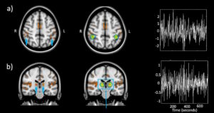 МРТ сверхвысокого поля показывает, как синий свет стимулирует мозг