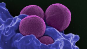 Tekoäly löytää uuden antibioottiluokan 12 miljoonan yhdisteen pesun jälkeen