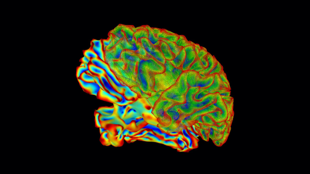 Aivoimplantti saa aikaan huomattavan toipumisen potilailla, joilla on vakava aivovamma PlatoBlockchain Data Intelligence. Pystysuuntainen haku. Ai.