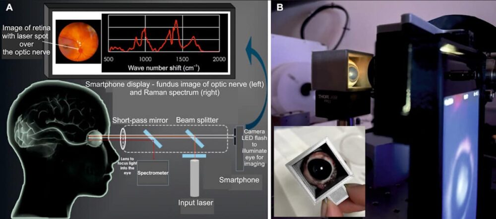 Pihuseade kasutab ajukahjustuse diagnoosimiseks silmadele ohutut võrkkesta spektroskoopiat – Physics World
