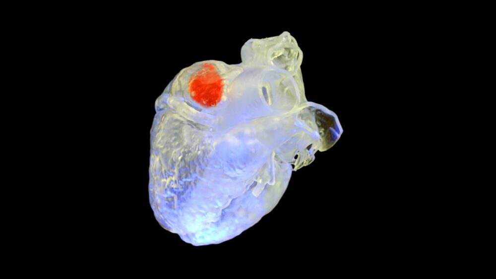 Ультразвуковий 3D-принтер одного дня зможе відновити органи в тілі без хірургічного втручання