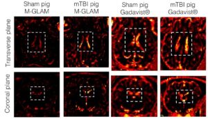 Macrophage-adhering micropatches enable MRI to detect brain inflammation – Physics World