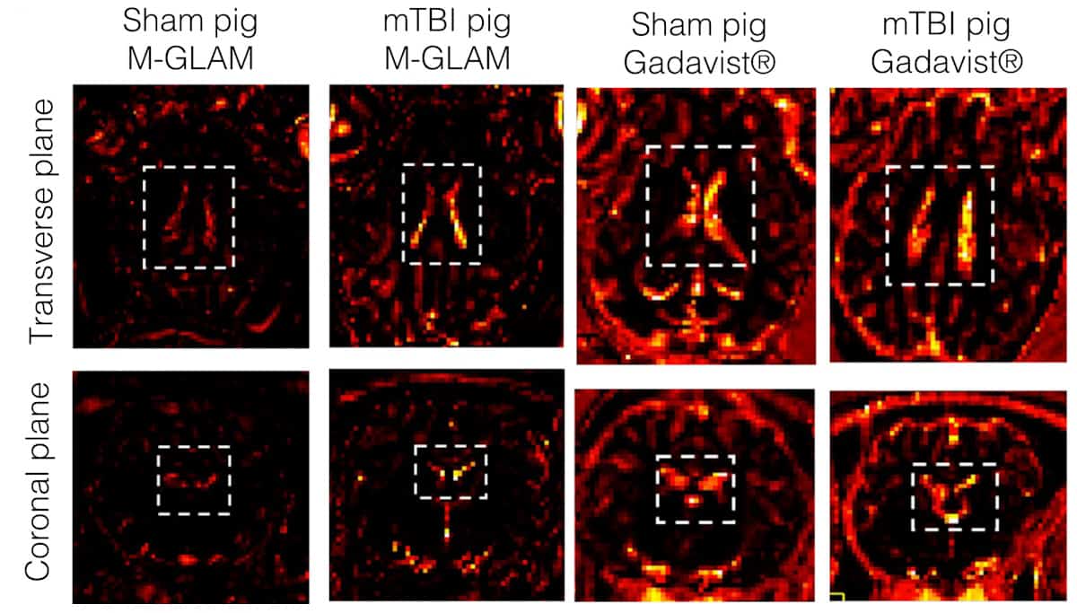 خرائط التصوير بالرنين المغناطيسي لخنازير التحكم والخنازير المصابة بـ TBI الخفيف
