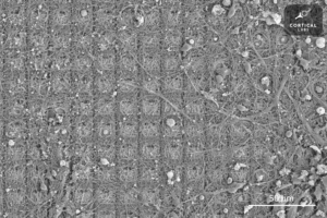Γουρούνια με ανθρώπινα εγκεφαλικά κύτταρα και βιολογικά τσιπ: Πώς οι υβριδικές μορφές ζωής που καλλιεργούνται στο εργαστήριο εξοργίζουν την επιστημονική δεοντολογία