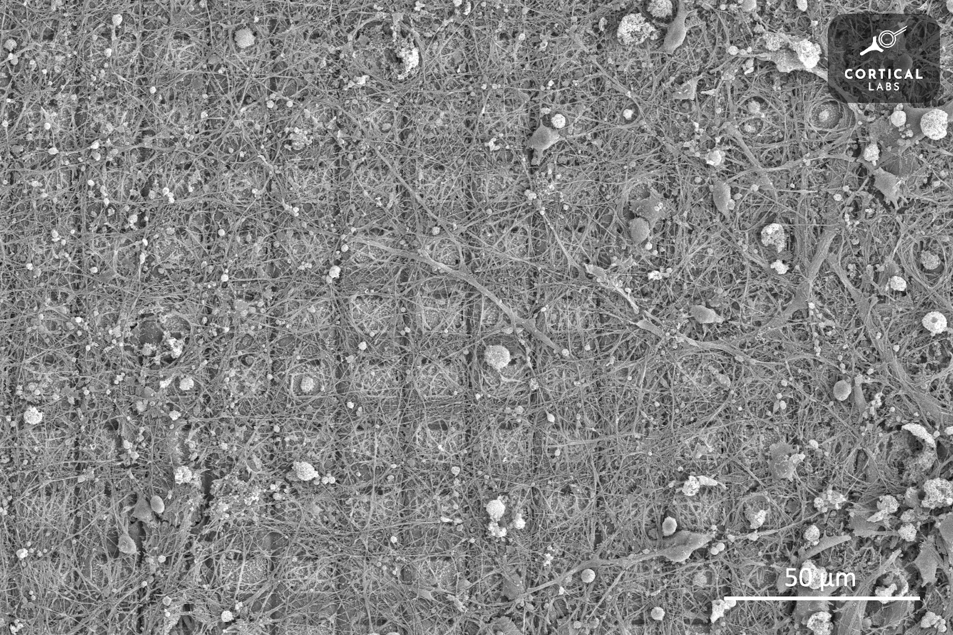 Γουρούνια με ανθρώπινα εγκεφαλικά κύτταρα και βιολογικά τσιπ: Πώς οι υβριδικές μορφές ζωής που καλλιεργούνται στο εργαστήριο εξοργίζουν την επιστημονική δεοντολογία