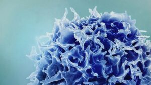 Terapia celulară vizează tumorile cerebrale mortale în două studii clinice