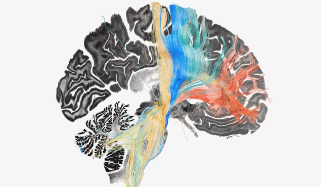 Kortlægning af hjernekredsløb afslører potentielle behandlingsmål for hjernesygdomme – Physics World