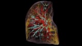 3D-kuva ihmisen keuhkoista